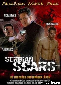 Фильм: Шрам Сербии - Serbian Scars